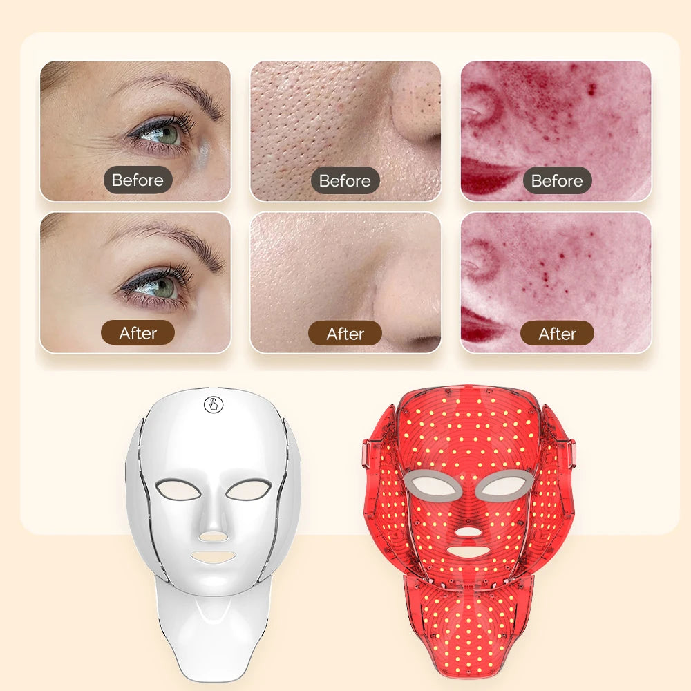 LED Light Therapy Mask™ – Face & Neck